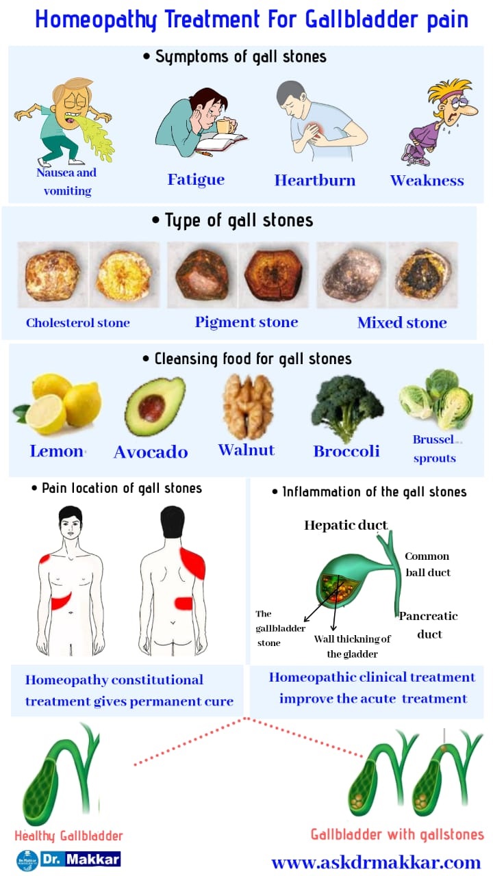 gallstones-cholelithesis-homeopathic-treatment-gall-bladder-stone